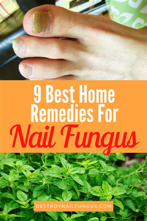  Natural At-Home Remedies for Common Nail Problems 