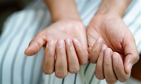  Understanding Hand Infection 