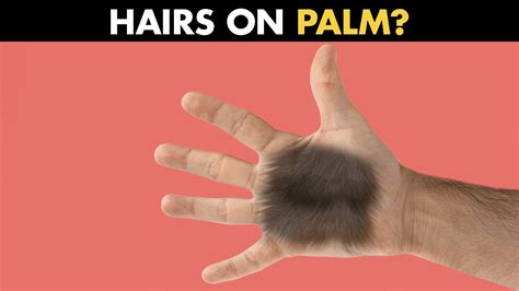 A Common Phenomenon: Experiences Involving Hair on the Palms