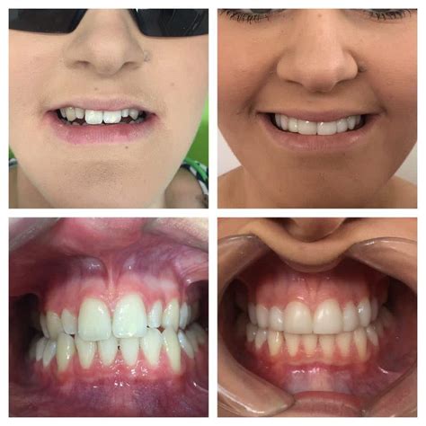 A Game-Changer for Your Smile Transformation