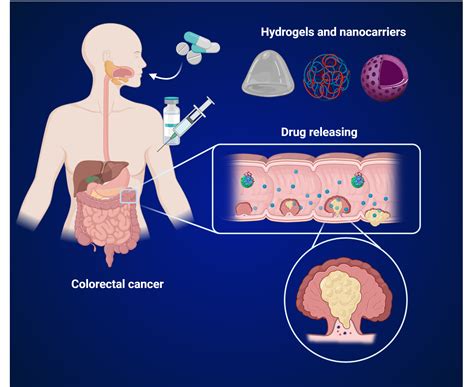 A Holistic Approach: Complementary Therapies in the Treatment of Colorectal Cancer