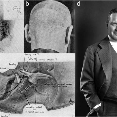 A Symbolic Analysis of the Dream Portraying the Act of Incision