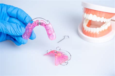 Analyzing the Impact of Fractured Orthodontic Appliances Dreams on Mental and Emotional Well-being