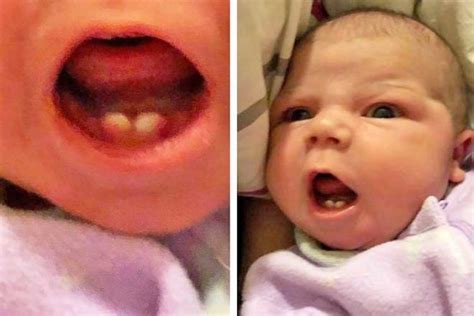 Are Babies Really Born with Teeth? Separating Fact from Fiction