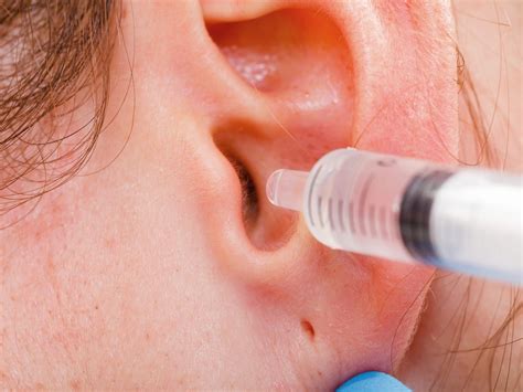 Battle of the Antiperspirants: How They Impact Earwax