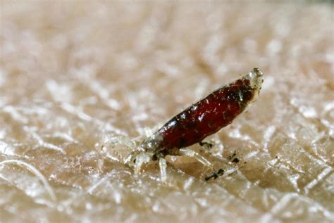 Beyond Parasitism: Surprising Beneficial Roles of Lice