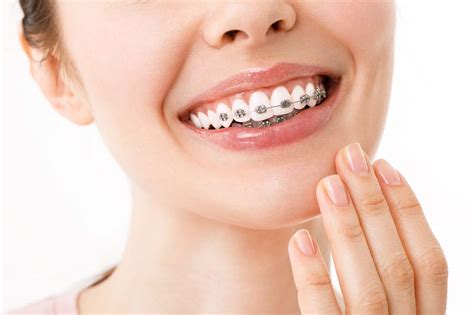 Choosing the Right Type of Orthodontic Treatment: Which Option is Perfect for You?
