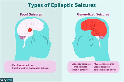 Common Types of Epileptic Episodes in Dreams