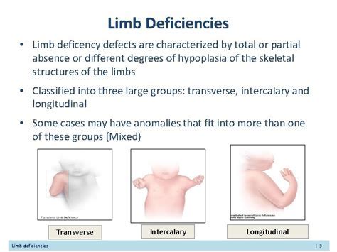 Cultural Significance: Perspectives on Dreams Related to Absent Limbs