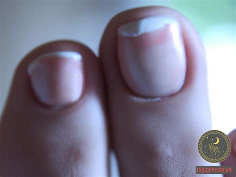 Cultural Significance and Interpretations of Prominent Toenails in Dream Analysis