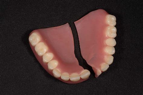 Dealing with a Broken Denture: Steps to Take for Repairing Your Dental Appliance