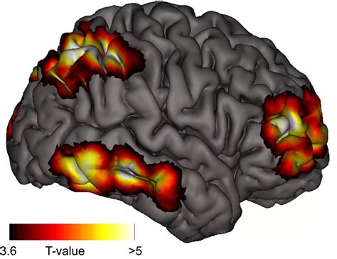 Deciphering the Brain's Role in Lucid Reverie