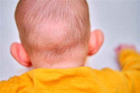 Deciphering the Significance of a Vision Involving a Hairless Infant