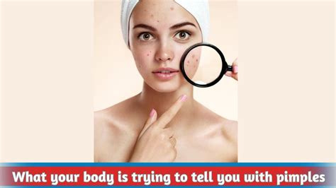 Decoding the Symbolism behind Burst Pimples: Unveiling the Hidden Messages in Your Dreams