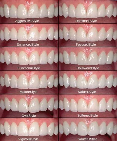 Dental Crowns vs. Veneers: Which Option Works Best for You?