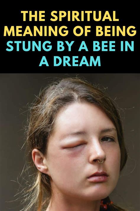 Dream Decoding: The Significance of Being Stung by a Bee on the Nose