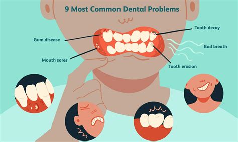 Effective Strategies for Dental Problem Prevention