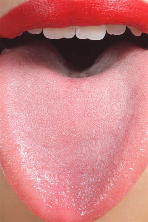 Examining when to seek medical attention for persistent or concerning dark patches on the tongue