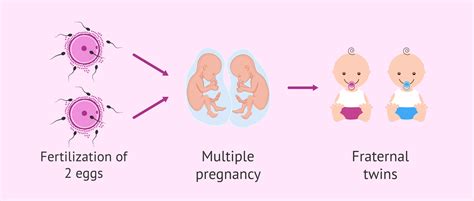 Exploring Assisted Reproductive Techniques for Twins