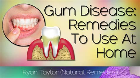 Exploring Natural Solutions: Home Remedies for Controlling Gum Inflammation