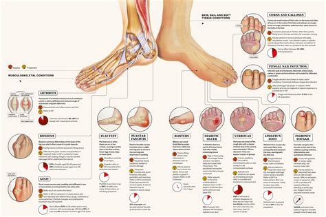 Exploring Symbolic Meanings: Deciphering Messages in Foot Ailments across Different Scenarios