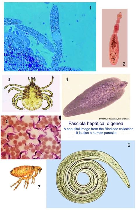 Exploring the Astonishing Diversity of Giant Parasites: A Window into Their Ecological Role