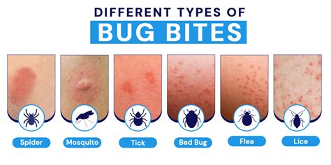 Exploring the Emotional Impact of Facial Insect Bites: Unveiling the Inner Turmoil