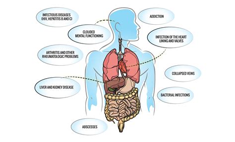 Exploring the Physical Consequences: How Imaginary Poison can Harm Your Health