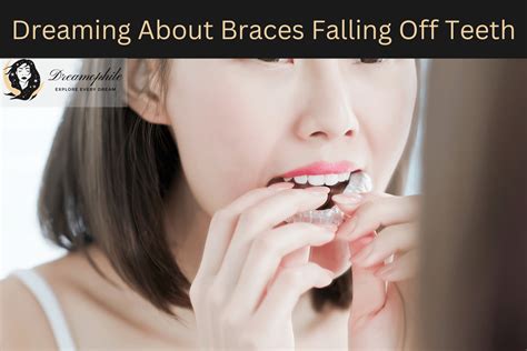 Exploring the Physical Risks of Actual Braces Falling