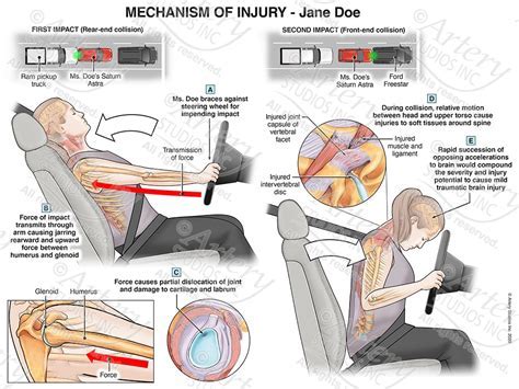 Exploring the Psychological Significance of Dreaming About a Vehicle Collision