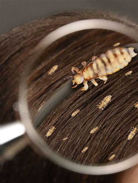 Exploring the Roots of Hair Lice Dreaming