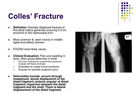 Exploring the Significance of the Fractured Shell: Unveiling the Disruption of Established Patterns