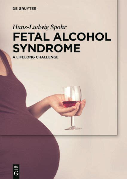 Fetal Alcohol Syndrome: A Lifelong Burden