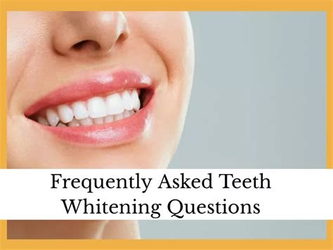 Frequently Asked Questions About Teeth Whitening