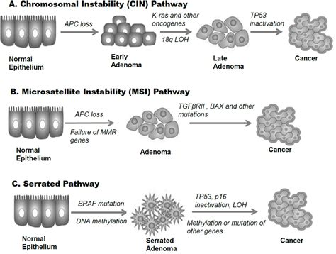 Inherited Factors in Bowel Cancer Development