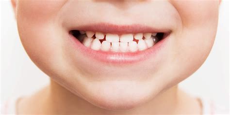 Interpreting Teeth-related Nightmares in Children