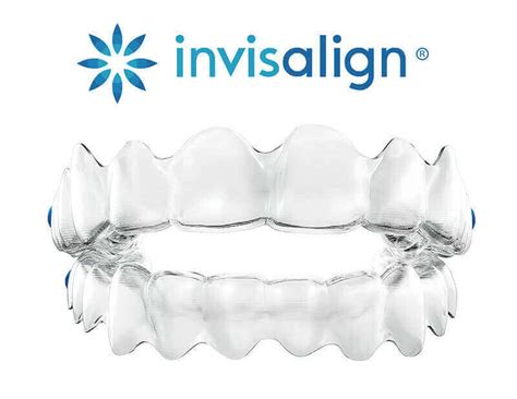 Invisalign: The Groundbreaking Transparent Aligner System for Subtle Alignment of Teeth