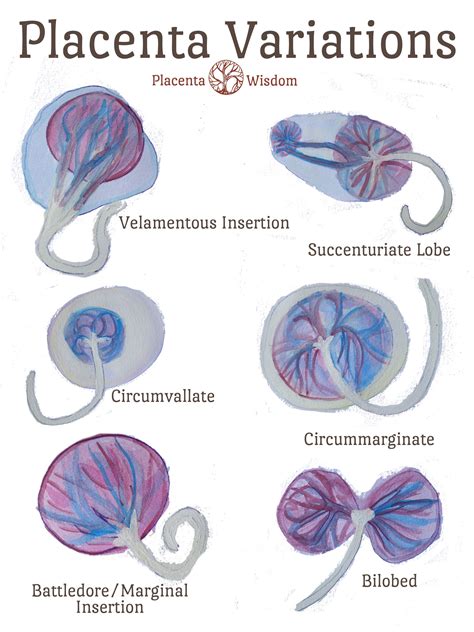 Is Dreaming About Delivering the Placenta Normal?