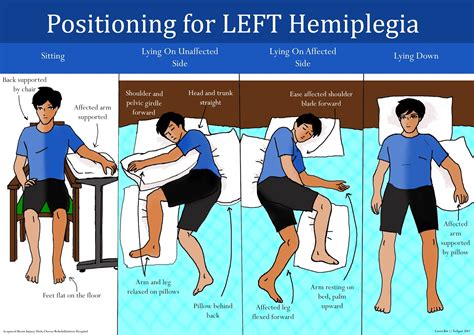 Living with Enlarged Limbs: Managing Techniques and Day-to-Day Support