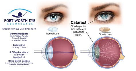 Long-term Effects and Follow-up Care Post-Eye Surgery