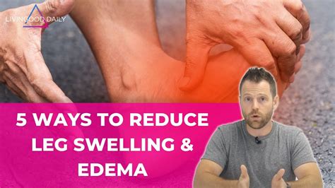 Managing Swelling in the Lower Extremities: Home Remedies and Self-care Tips 