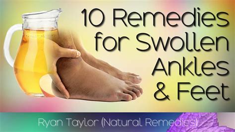 Medical Treatments for Swollen Feet: Medications and Procedures