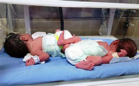 Methods for Analyzing and Decoding Dreams Involving the Birth of Premature Twins