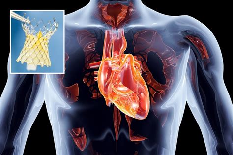 Pioneering the Vision of Future Cardiac Procedures