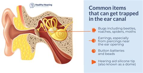 Possible Meanings of Bugs Emerging from the Ear