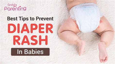 Preventing Diaper Rash in Infant Girls