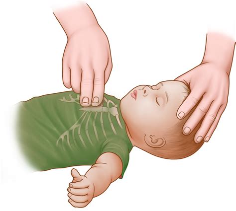 Proper Technique for Administering CPR on an Infant