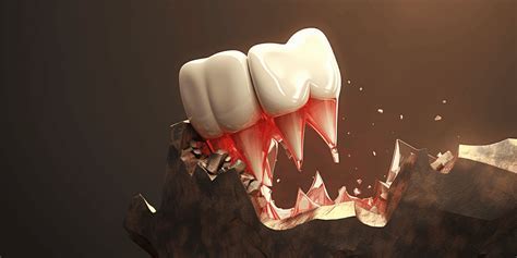 Psychological Insights into Enigmatic Tooth Loss Fantasies