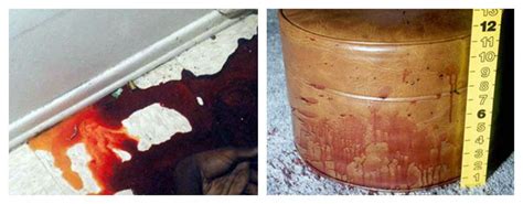 Psychological Significance of Bloodstains on Attire