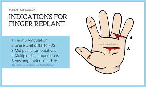 Recognizing the Indications of an Affected Thumb